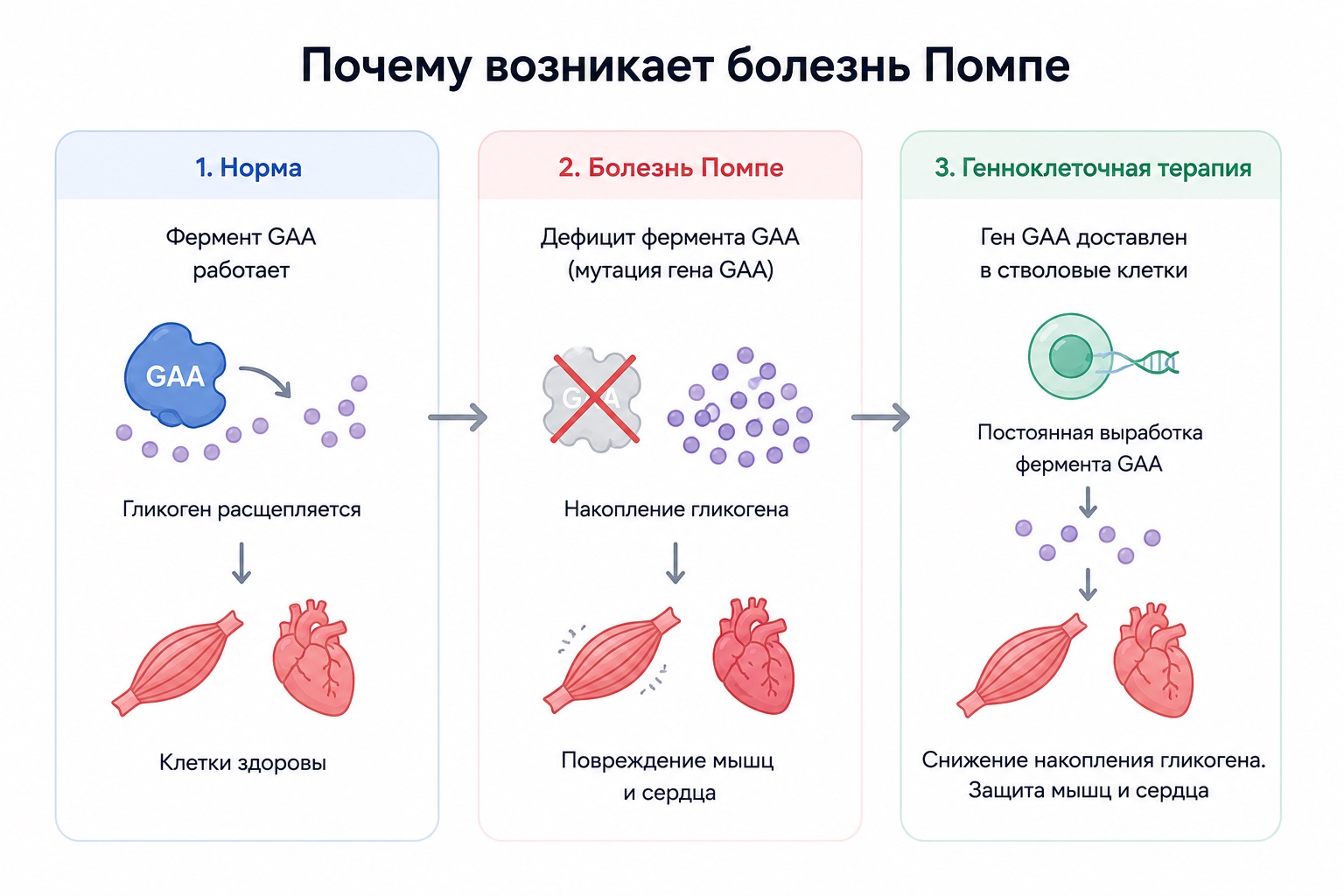 Почему возникает болезнь Помпе: 1. Норма — фермент GAA работает, гликоген расщепляется, клетки здоровы. 2. Болезнь Помпе — дефицит фермента GAA из-за мутации гена, накопление гликогена, повреждение мышц и сердца. 3. Генно-клеточная терапия — ген GAA доставлен в стволовые клетки, постоянная выработка фермента, снижение накопления гликогена, защита мышц и сердца.