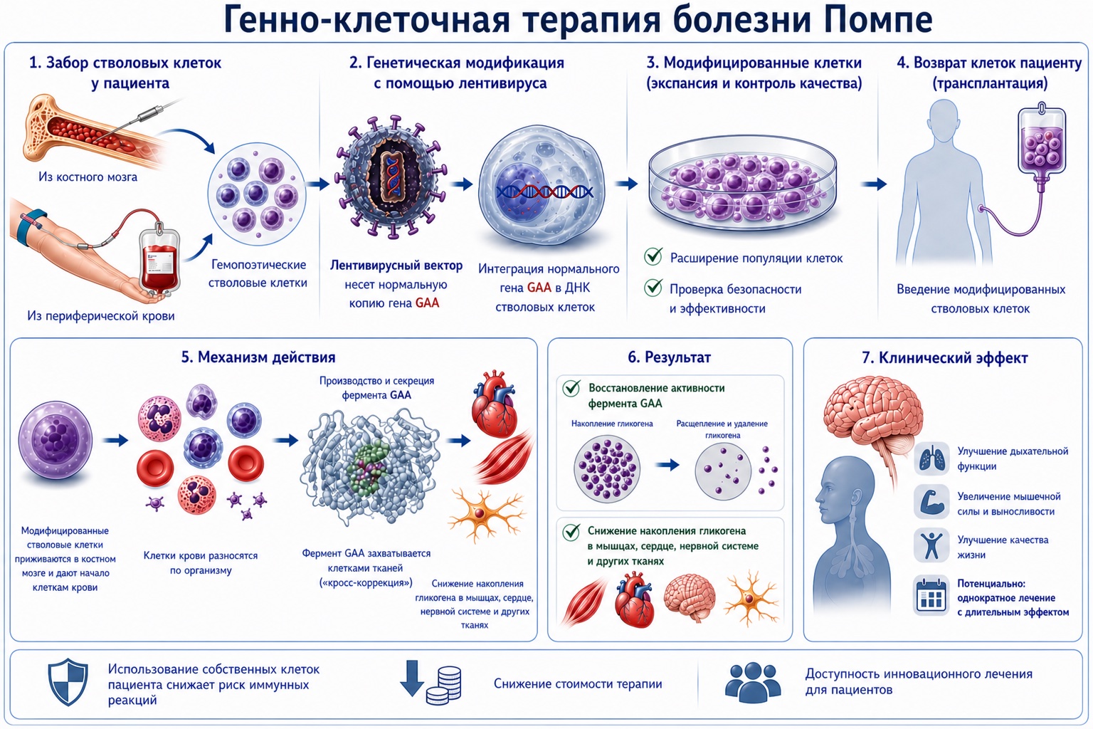 Генно-клеточная терапия болезни Помпе — 7 этапов. 1. Забор стволовых клеток у пациента (из костного мозга или периферической крови) — гемопоэтические стволовые клетки. 2. Генетическая модификация с помощью лентивируса: лентивирусный вектор несёт нормальную копию гена GAA, интеграция гена GAA в ДНК стволовых клеток. 3. Модифицированные клетки: экспансия и контроль качества — расширение популяции клеток, проверка безопасности и эффективности. 4. Возврат клеток пациенту (трансплантация) — введение модифицированных стволовых клеток. 5. Механизм действия — клетки приживаются в костном мозге, разносятся по организму, фермент GAA захватывается тканями («кросс-коррекция»), снижается накопление гликогена в мышцах, сердце и нервной системе. 6. Результат — восстановление активности фермента GAA, снижение накопления гликогена в тканях. 7. Клинический эффект — улучшение дыхательной функции, увеличение мышечной силы и выносливости, улучшение качества жизни, потенциально однократное лечение с длительным эффектом.